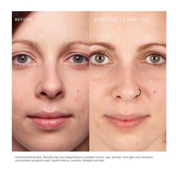 rodan fields eye lash boost serum 5ml - Picture 4 of 9